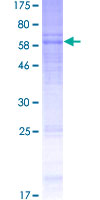 12.5% SDS-PAGE Stained with Coomassie Blue.